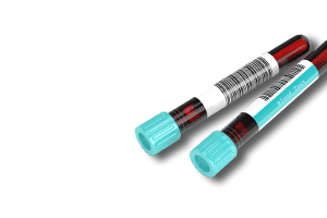 two blood vials