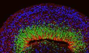 lab brain model science