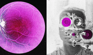age related sight loss wired